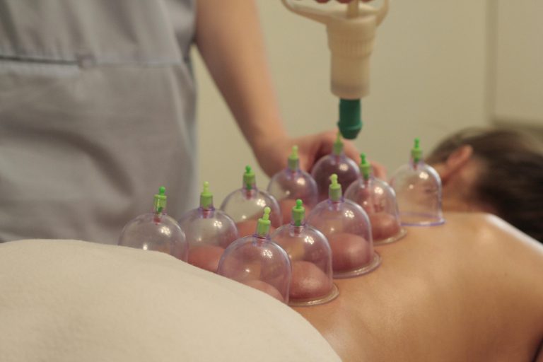 Benefit of vacumm cupping therapy
